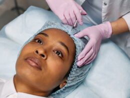 Close-up of a cosmetic procedure using injectables on a woman's forehead in a clinic setting.